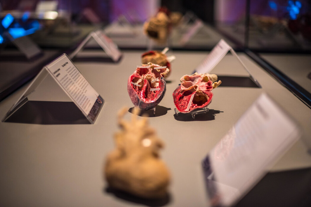 Body Worlds